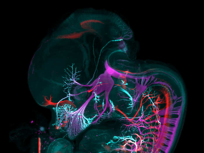 A mouse embryo stained for motor nerves (in red), sensory nerves (in magenta), and nerve endings (in cyan).