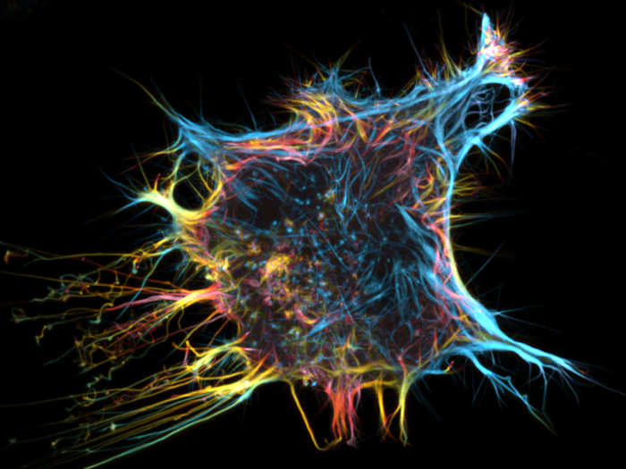 Fluorescent protein in a living HeLa cell, which is the oldest human cell line used in scientific research.