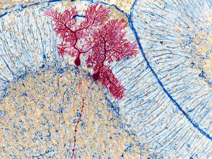 Dye-injected nerve cells inside a mouse