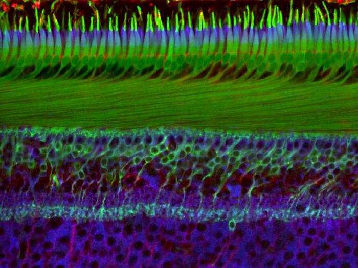 No. 20: The layers of a human retina that enable people to see.