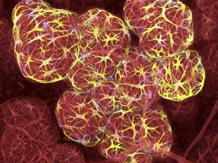 No. 17: Breast tissue, with milk-filled spheres (in red) surrounded by muscle cells that squeeze out milk (in yellow), and immune cells that detect infection (in blue).