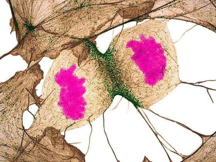 No. 11: A human fibroblast, which is vital for the healing of damaged organs, undergoes cell division. (DNA is stained magenta.)