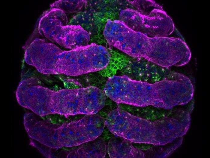 No. 5: A spider embryo with its surface in pink and microtubules in green.