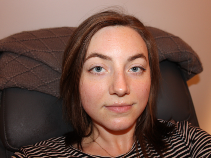 ... and after. While I think a greater effect would be seen after a few cryofacials, my skin felt noticeably smoother, and it had more of a glow. I couldn