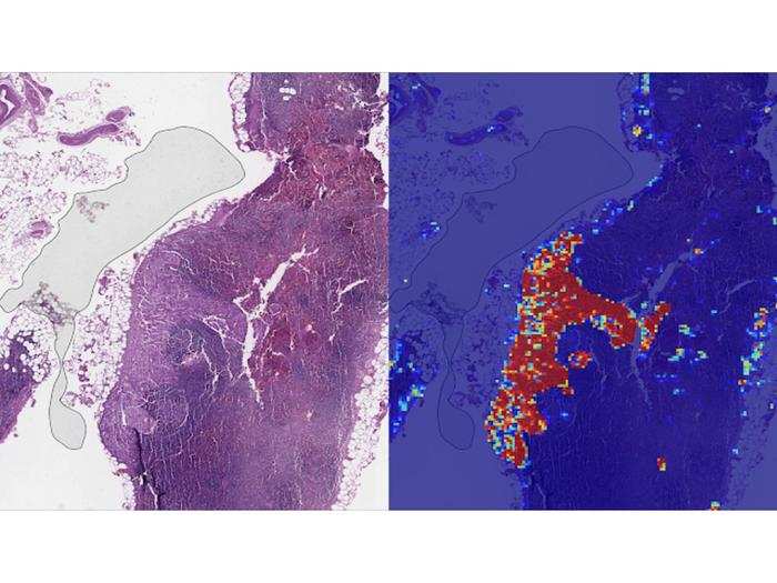 Studies have shown that cancer researchers using algorithms to assist them can provide more accurate diagnoses with the algorithms than when they work alone.