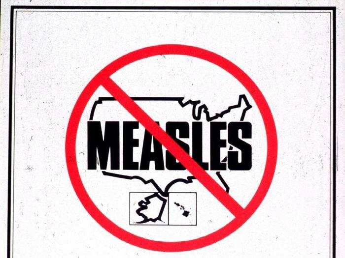 Recently, people have brought measles cases back to the US after traveling abroad in places like Israel, France, and Italy, where outbreaks are occurring. New York City has now logged at least 330 measles cases this year.