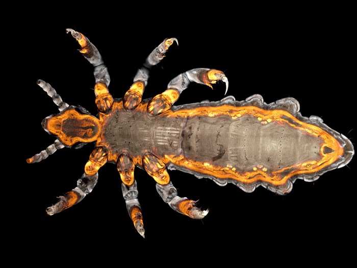 Head lice feed on blood from the human scalp. (Feeling itchy yet?)