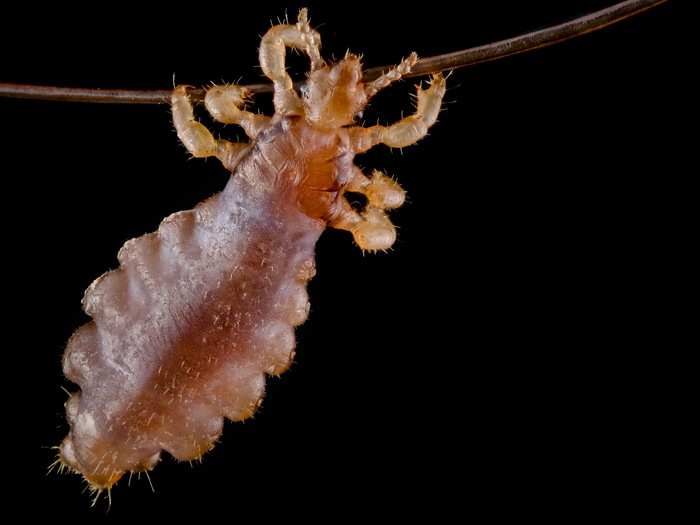 Even fewer people are cool with lice — especially when they cling to strands of hair, as this one is.