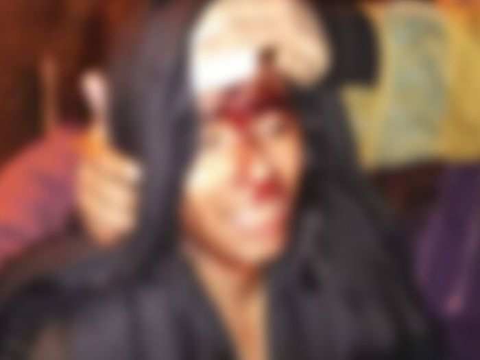 ​Aishe Ghosh, student union president was “brutally beaten up”