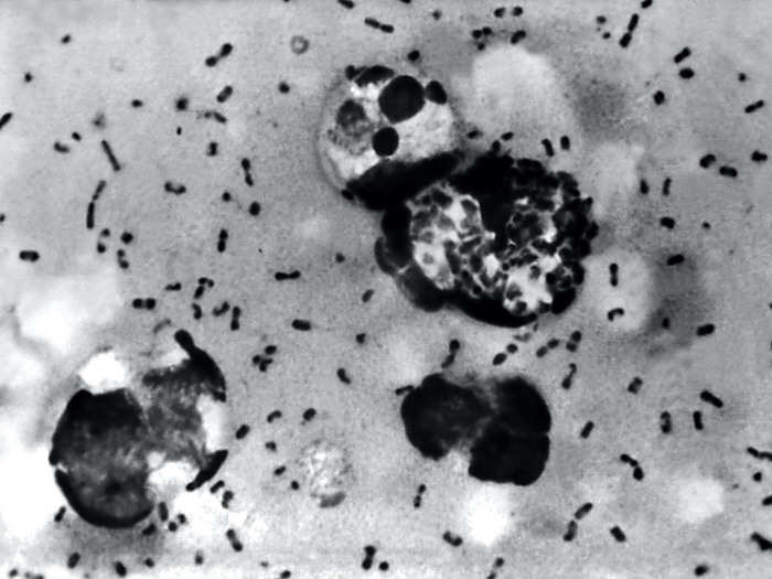 A 2014 bubonic plague scare resulted in quarantines in China.