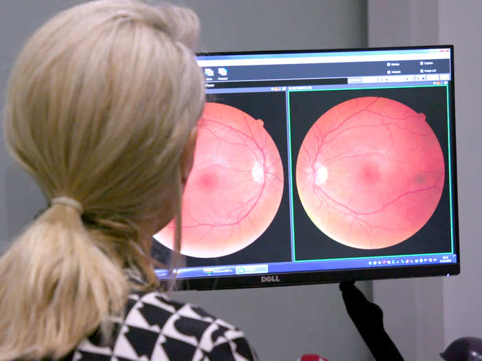 She uses a 3D scan of the retinas to ensure her lenses will fit properly atop the cornea. If done properly, the lenses will feel "very, very normal," Sweeney said.