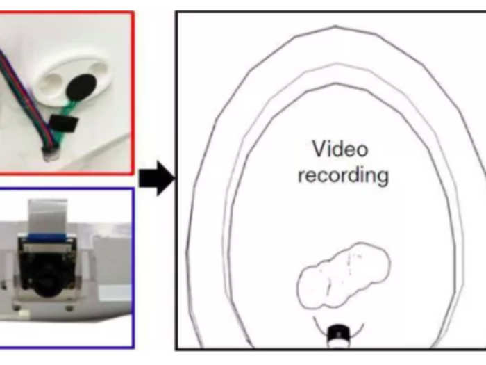 Stool samples are recorded on video and analyzed by algorithms that identify abnormal stool consistencies.