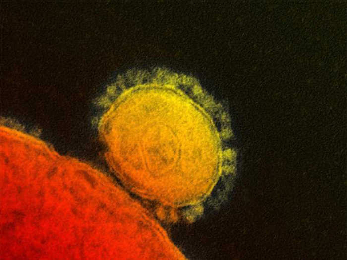 The CDC praised the handling of the MERS virus at a hospital in Indiana, where 50 healthcare workers who were exposed to the virus self-isolated to prevent the spread of the virus. The CDC said their rapid and thorough isolation of exposed workers helped them avoid a chain of transmission.