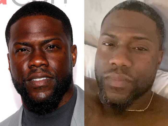 Kevin Hart described himself as a "frequent dyer" while showing his partially gray hair on Instagram.