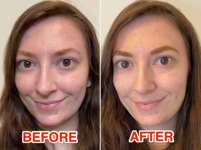 One day after using both products, I saw noticeable results — albeit short-lived ones.