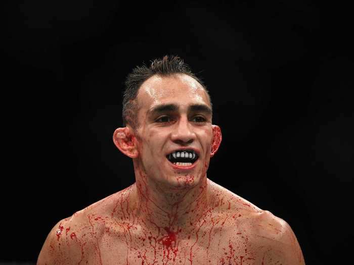 This is the UFC lightweight Tony Ferguson. He