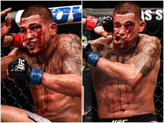 Anthony Pettis bled so much in a 2018 stoppage loss to Ferguson that he splattered ringside observers, commentators, and officials with dollops of blood.