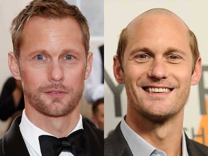 Alexander Skarsgård shocked everyone when he shaved his hair.