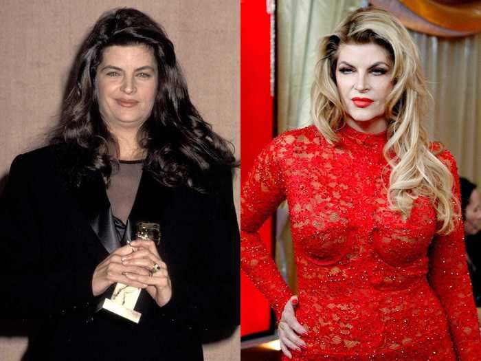 Kirstie Alley lost 75 pounds by joining Jenny Craig.