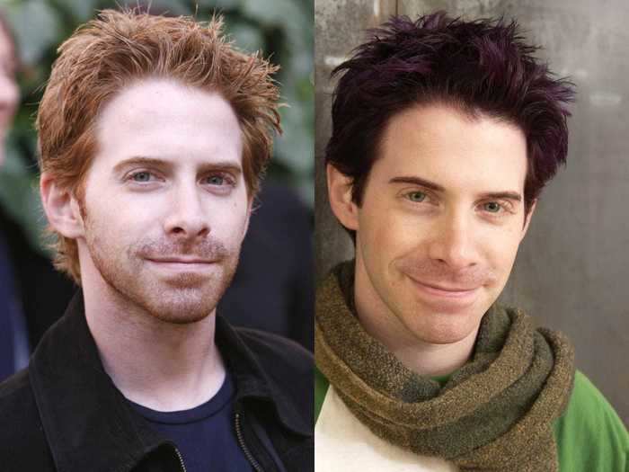 Seth Green has had almost every hair color under the sun, but he