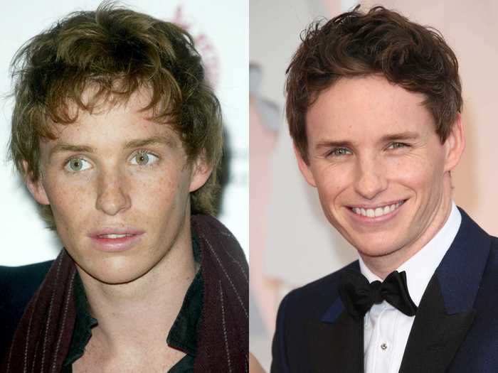 Eddie Redmayne has dark hair now, but his natural hair is lighter.