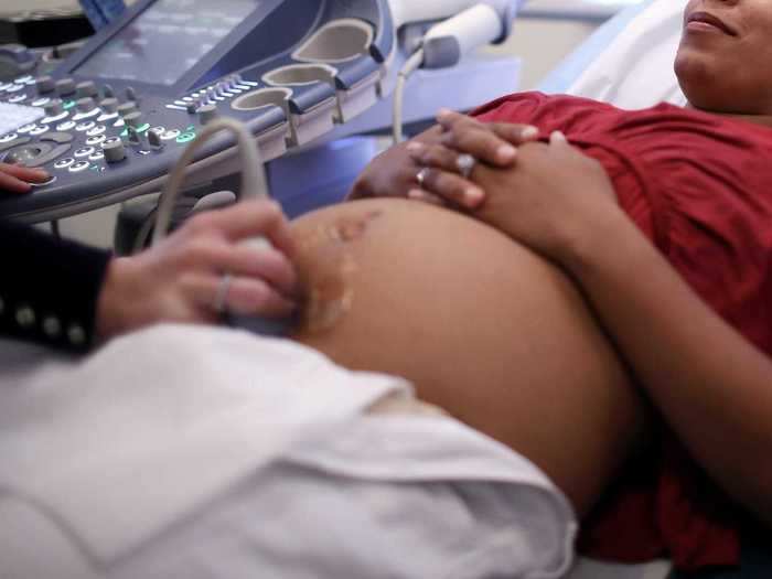 Delivering a premature baby has been linked to a greater risk of heart disease.