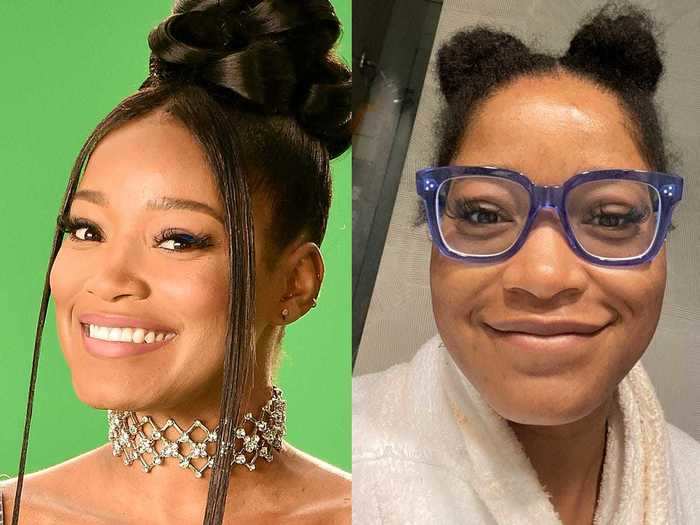 On September 3, Keke Palmer reflected on her journey to clear skin.