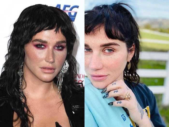 Kesha asked for advice on "feeling normal" while showcasing her freckles.