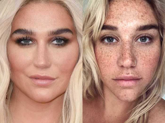 Kesha showed off her freckles in a Twitter post that quickly went viral that month.