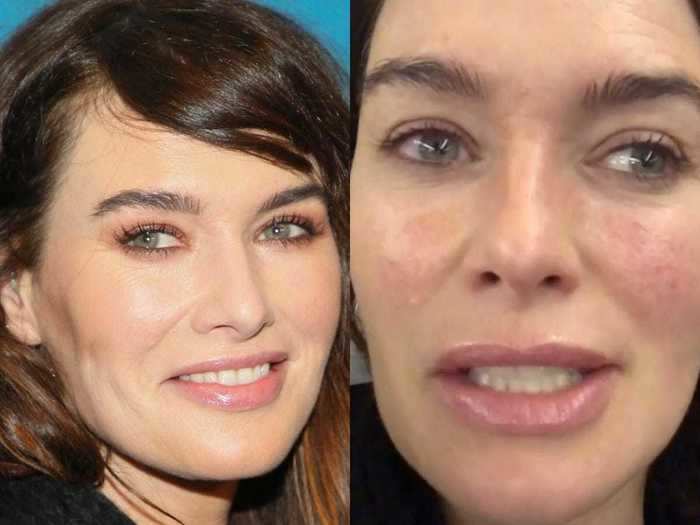 Lena Headey got real about her skin at the start of 2019.
