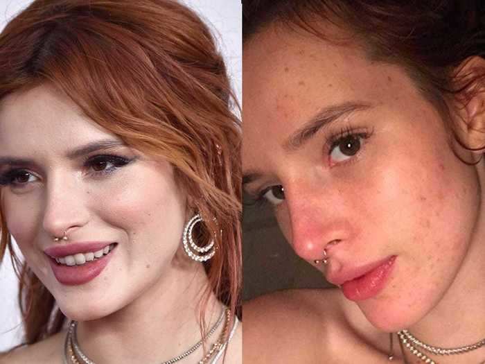 Bella Thorne celebrated her changing skin with a selfie in October 2017.
