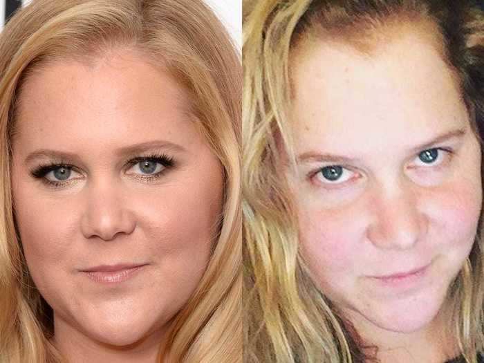 Amy Schumer went completely natural for a November 2016 photo.