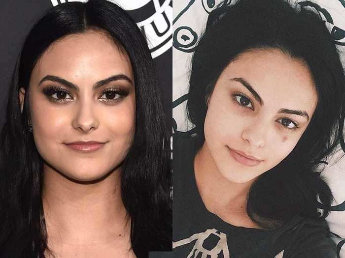 Camila Mendes then used a fresh-face photo to discuss a skin condition she experiences.