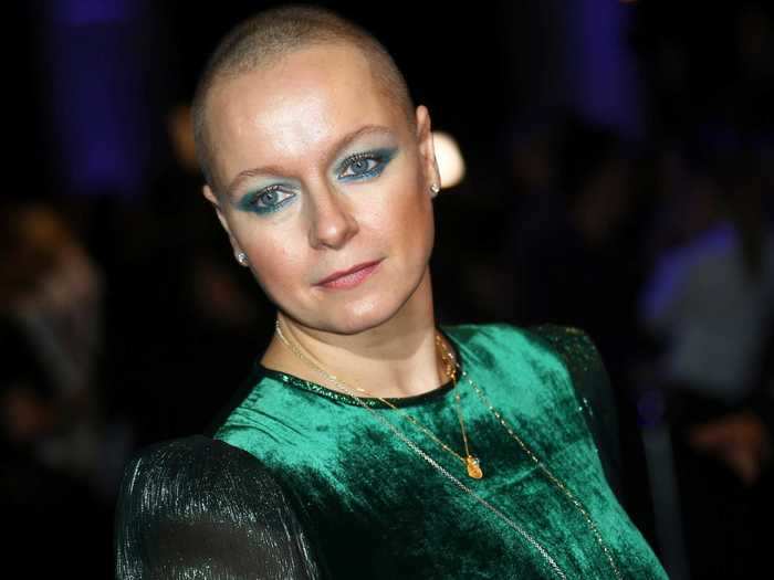 Samantha Morton shaved her head for the role as the show