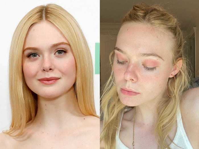 Elle Fanning used Instagram to open up about having eczema on her face.