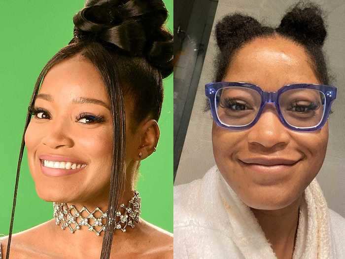 Keke Palmer reflected on her journey to clear skin on Twitter.