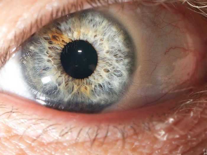 Weed can also turn your eyes red.