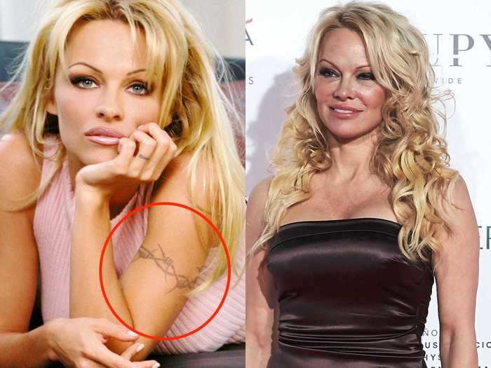 Pamela Anderson had barbed wire tattooed on her arm for a movie — she decided to have it removed 19 years later.