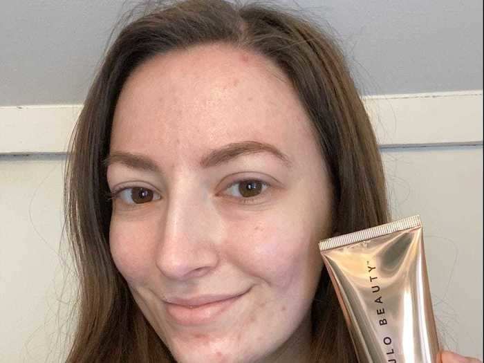 The celebrity products made my face glow the first day I used them, but they also irritated my skin.