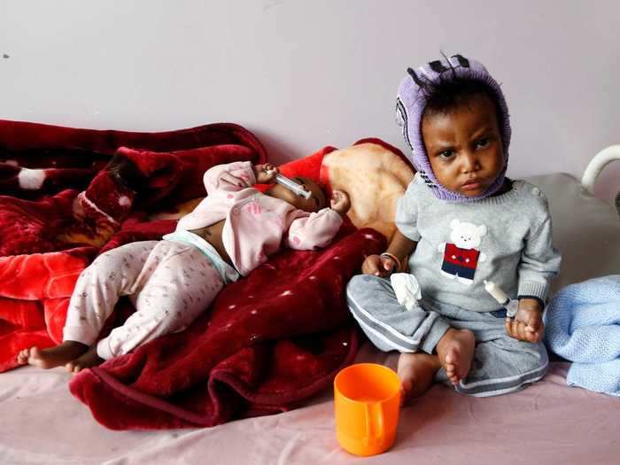 Last month, the World Food Programme said around 400,000 children could die in Yemen by the end of this year without urgent intervention.