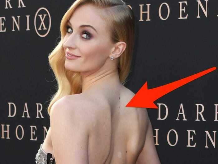 In August 2018, the Queen of the North actress got a delicate North Star tattoo on her spine.