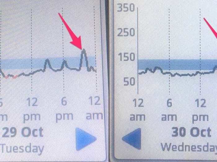 When I was allowed to eat my regular diet again, I stopped seeing the morning blood sugar crashes, and only noticed a small peak in my blood sugar levels each night around dinnertime.