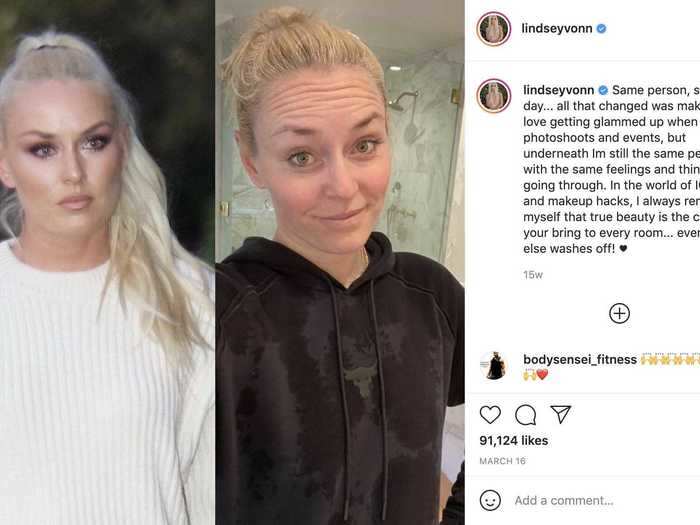 In March, Olympian Lindsey Vonn shared photos of herself with and without makeup.