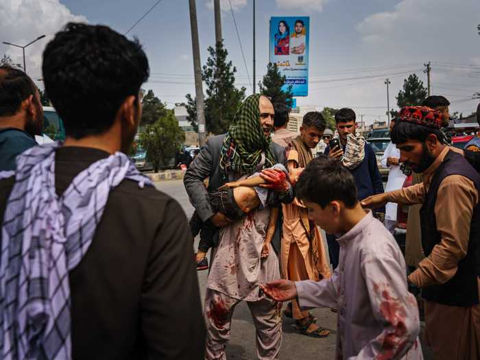 Yam said it was "shocking" to see people get wounded and beat in the street by Taliban fighters.