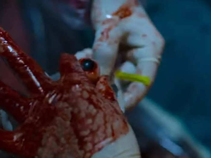 Some staff members are harvesting organs.