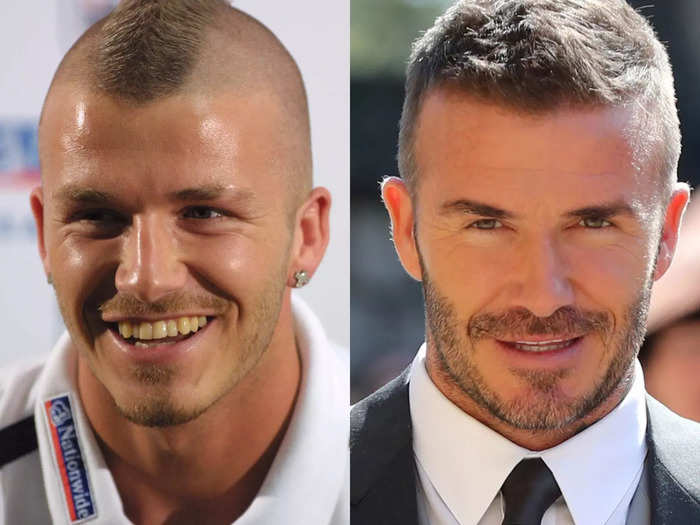 David Beckham used to have a slit in his left eyebrow that he has let grow in.