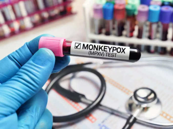 Monkeypox