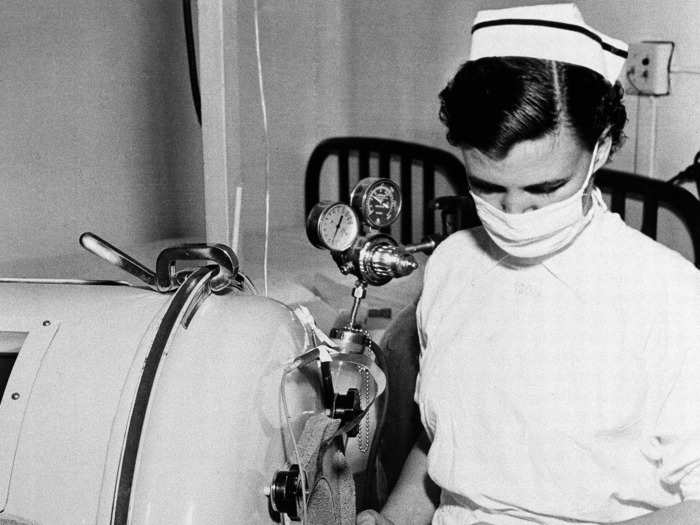 September 23, 1952: Two-month-old Martha Ann Murray is watched over by a nurse in an iron lung.