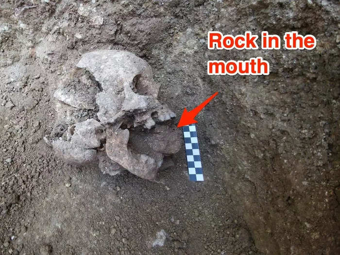 A 10-year old Roman child with a stone in the mouth.