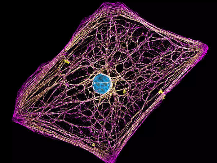 20. Human heart cells, captured at the Nationwide Children